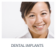 Dental Implants Columbia South Carolina
