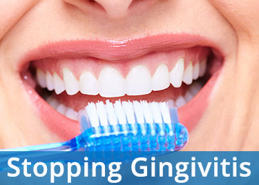 stopping gingivitis