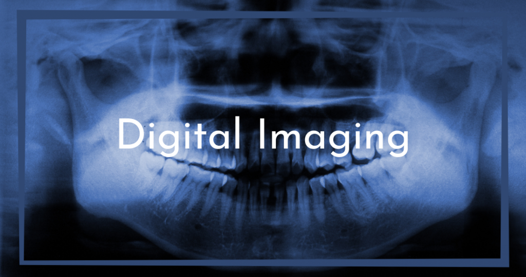 Digital X-rays Columbia SC